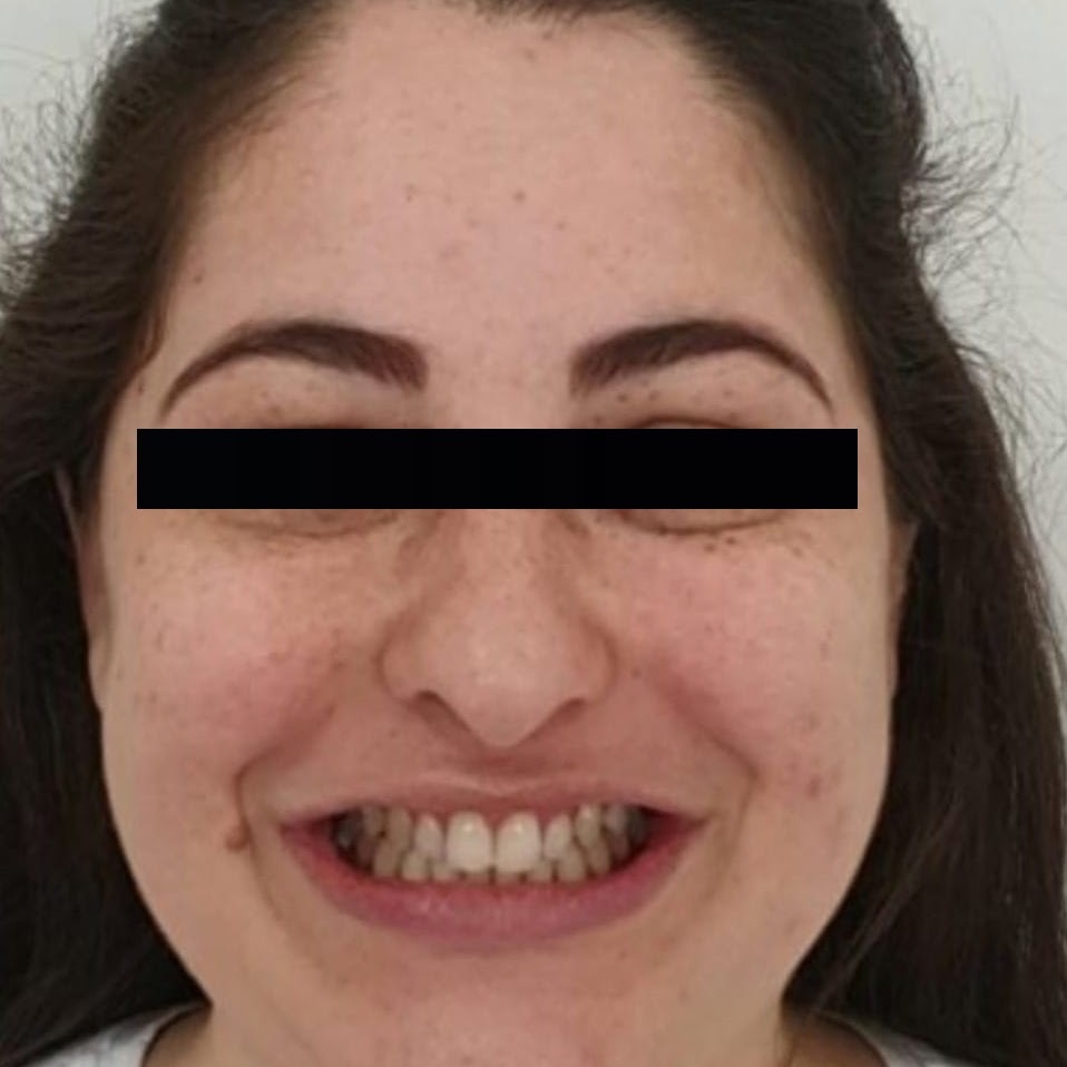 Caso 1 — antes