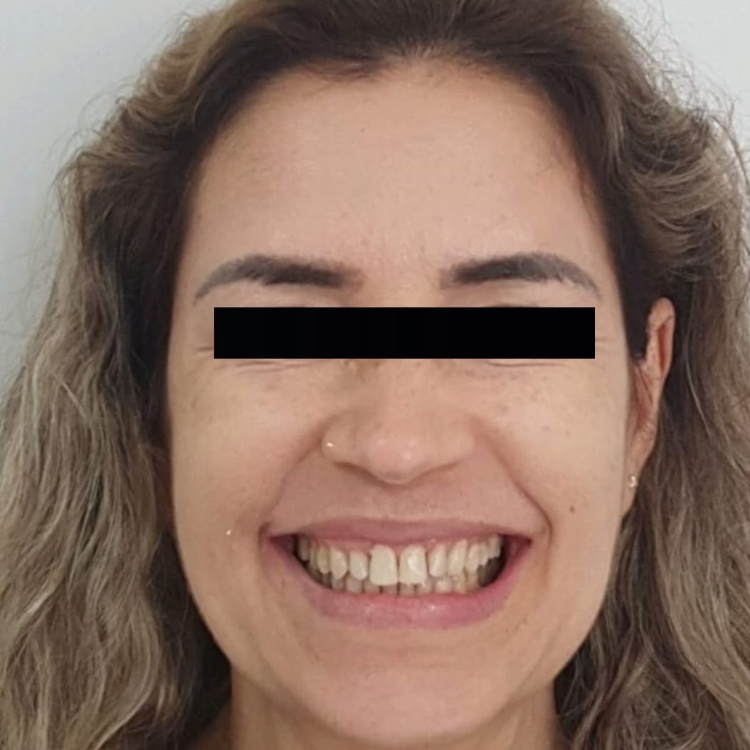 Caso 2 — antes