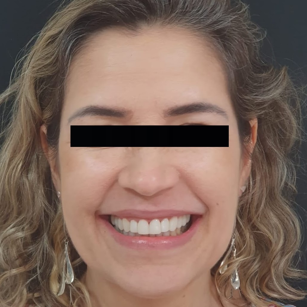 Caso 2 — depois